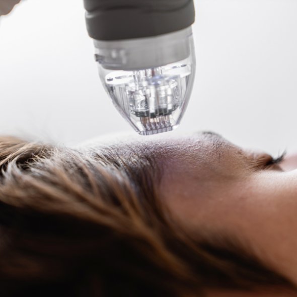 microneedling technician course tampa