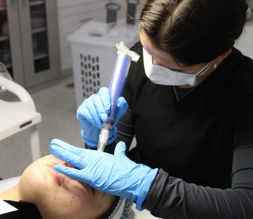 microneedling training tampa florida