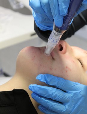 cursos microneedling cerca de mi