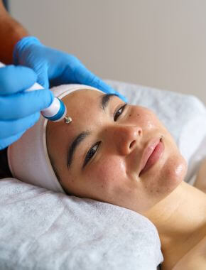 micrdodermabrasion skincare classes