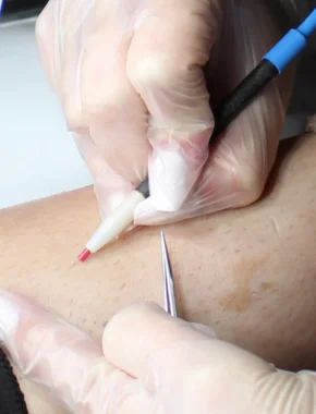 programa esteticista medica cerca largo