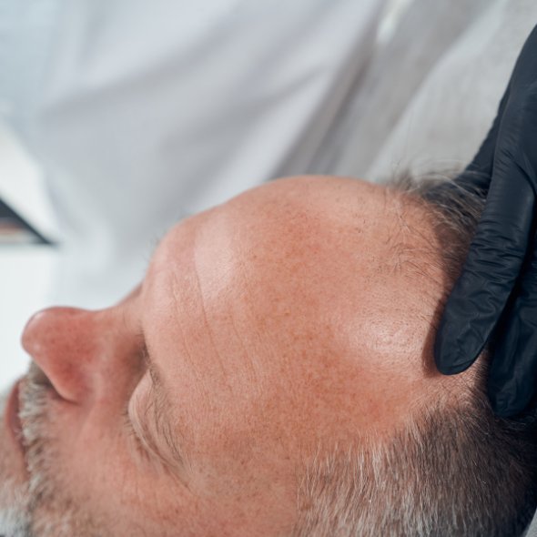 learn hair growth patterns