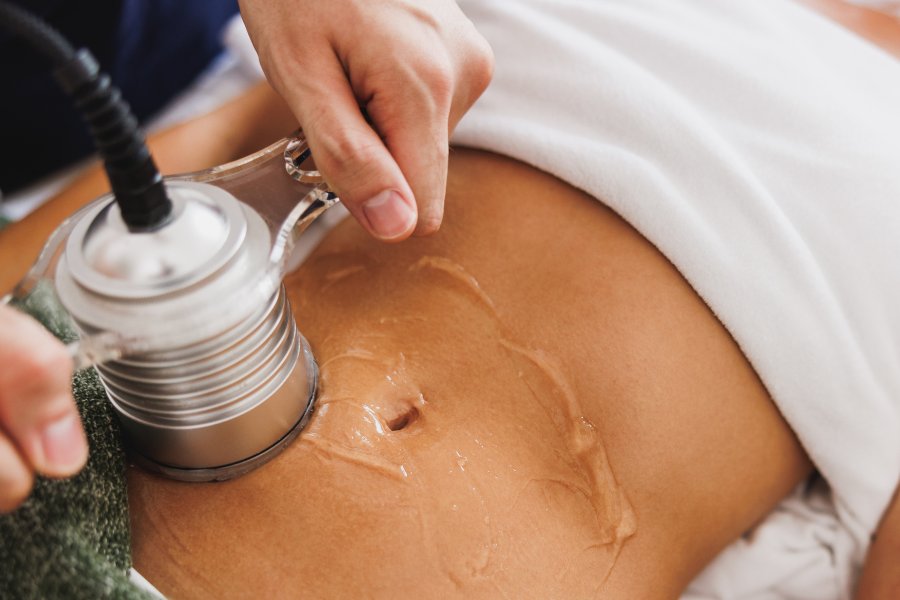 body contouring revenue tampa body contouring revenue tampa