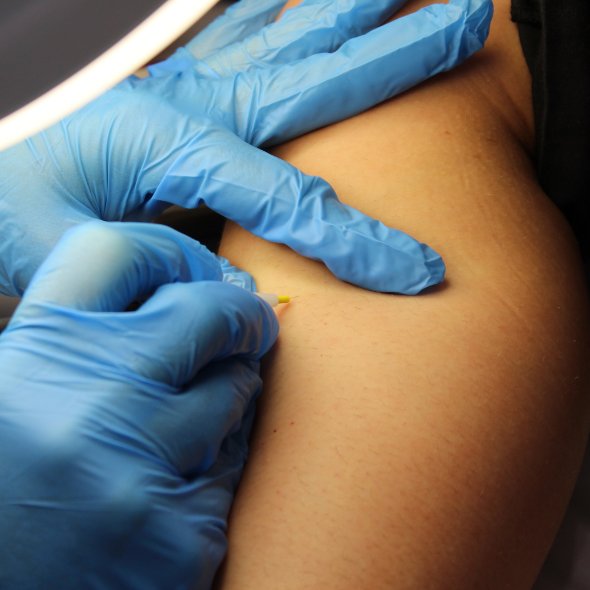 what is the electrolysis blend method