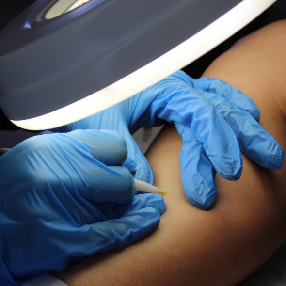 galvanic hair removal class