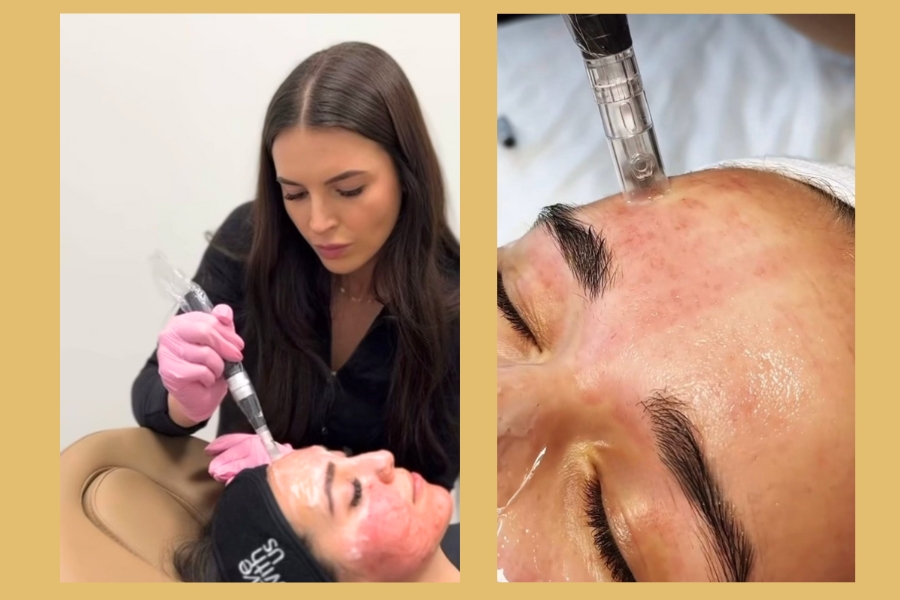 benefits of the collagen pin